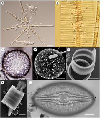 A review of the taxonomic diversity, host–parasite interactions, and experimental research on chytrids that parasitize diatoms